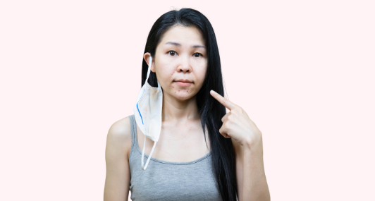 The Next 100 Days Will Be the Worst We’ve Seen for Maskne. Here’s Your Solution.